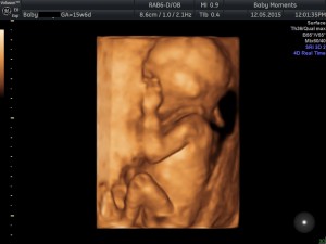 16 wks baby scan